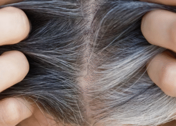 What Causes Gray Hair?